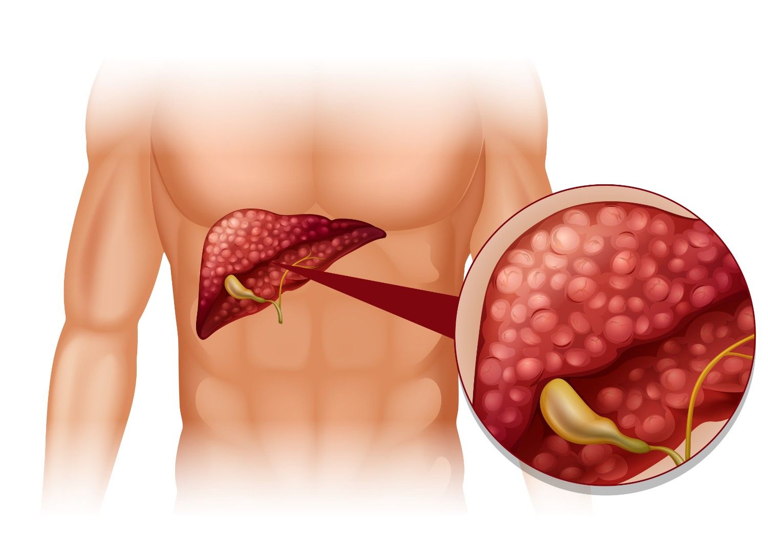 Dr. Akshay Kulkarni - Gallstone Treatment in Aurangabad